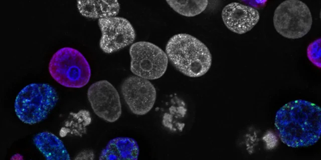 national-cancer-institute-L7en7Lb-Ovc-unsplash_2400