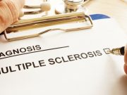 Multiple Sclerosis