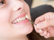 Do Dental Veneers Require Specific Aftercare Instructions? Dental Veneers Require Specific Aftercare Instructions