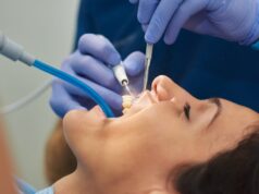 How Can Plaque Be Effectively Removed from Teeth? Dental