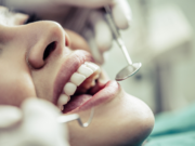 Are Porcelain Veneers Safe for Sensitive Teeth?