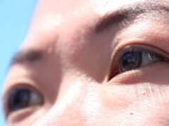 5 Misconceptions People Have Before Considering an Eyebrow Lift