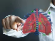 Explaining The Early Symptoms of Lung Cancer
